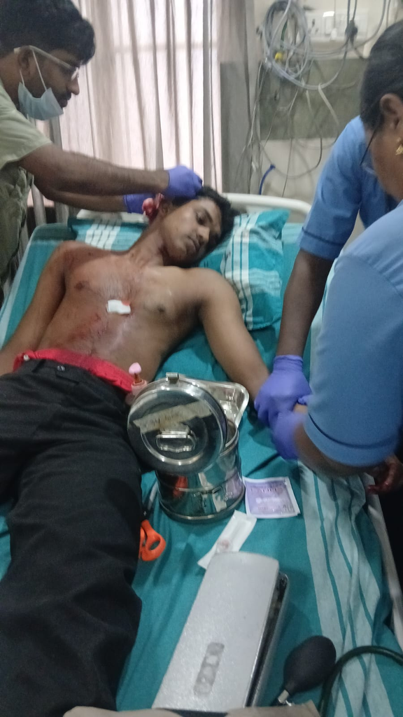 pulio attacked , wild animal attacked a youngster in vadakara